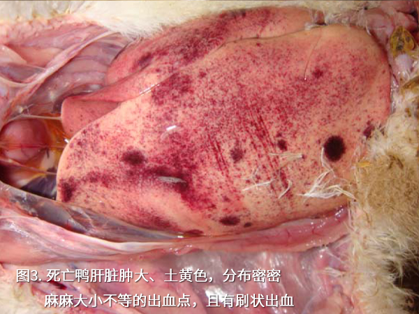 死亡鴨肝臟腫大、土黃色，分布密密麻麻大小不等的出血點，且有刷狀出血